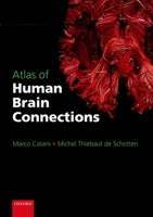 Atlas of Human Brain Connections 0199541167 Book Cover