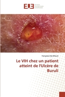 Le VIH chez un patient atteint de l'Ulcère de Buruli 6203435937 Book Cover