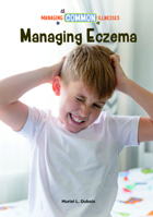 Managing Eczema B0FJFR3CJY Book Cover