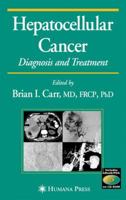 Hepatocellular Cancer: Diagnosis and Treatment (Current Clinical Oncology) 1588291251 Book Cover
