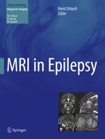 MRI in Epilepsy 3642438415 Book Cover