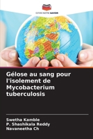 Gélose au sang pour l'isolement de Mycobacterium tuberculosis (French Edition) 6208257727 Book Cover