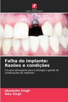 Falha do implante: Razões e condições (Portuguese Edition) 6207170024 Book Cover