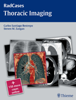 Thoracic Imaging (Radcases) 1604061871 Book Cover