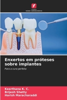 Enxertos em próteses sobre implantes (Portuguese Edition) 6630354192 Book Cover