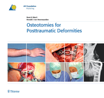 Osteotomies for Posttraumatic Deformities 3131486716 Book Cover