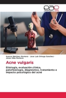 Acne vulgaris (Spanish Edition) 6630168283 Book Cover