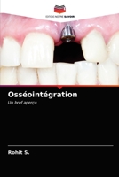 Osséointégration: Un bref aperçu 6203987018 Book Cover