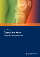 Operation Knie: Fragen an den Spezialisten 389935317X Book Cover