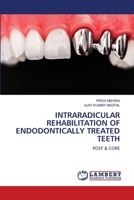 INTRARADICULAR REHABILITATION OF ENDODONTICALLY TREATED TEETH: POST & CORE 6206160300 Book Cover