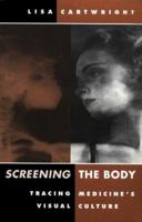 Screening the Body: Tracing Medicine's Visual Culture 0816622906 Book Cover