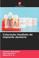 Colocação imediata de implante dentário (Portuguese Edition) 6208299780 Book Cover