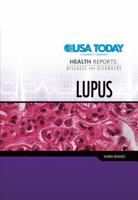 Lupus 0822585820 Book Cover