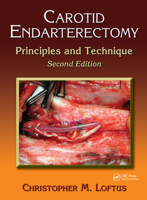 Carotid Endarterectomy: Principles and Technique 0824742850 Book Cover