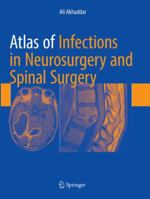 Atlas of Infections in Neurosurgery and Spinal Surgery 3319867733 Book Cover