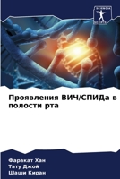 Проявления ВИЧ/СПИДа в по 6205684810 Book Cover