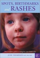 Spots, Birthmarks and Rashes: The Complete Guide to Caring for Your Child's Skin 1552976815 Book Cover