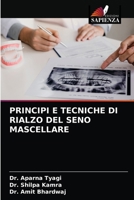 Principi E Tecniche Di Rialzo del Seno Mascellare 620337847X Book Cover