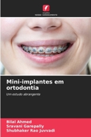 Mini-implantes em ortodontia: Um estudo abrangente 6206057070 Book Cover