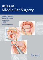 Atlas of Middle Ear Surgery 313145041X Book Cover