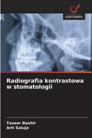 Radiografia kontrastowa w stomatologii (Polish Edition) 6208683807 Book Cover