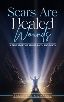 Scars Are Healed Wounds: A True Story About Abuse, Death and Faith B0GGMXR8JB Book Cover