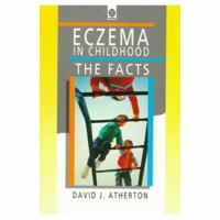 Eczema in Childhood: The Facts (Oxford Medical Publications) 0192623982 Book Cover