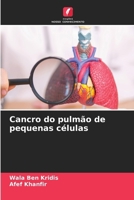 Cancro do pulmão de pequenas células (Portuguese Edition) 6209505538 Book Cover