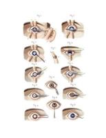 Cataract and Artificial Pupil Composition Notebook: Wide Ruled Note-Taking Book 171998140X Book Cover