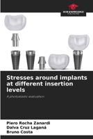 Stresses around implants at different insertion levels: A photoelastic evaluation 6208808367 Book Cover