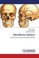 Mandibular Defects: To know and manage mandibular defects 3659396478 Book Cover