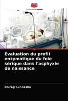 Évaluation du profil enzymatique du foie sérique dans l'asphyxie de naissance 6202950498 Book Cover