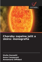 Choroby zapalne jelit a skóra: monografia (Polish Edition) 6630276175 Book Cover