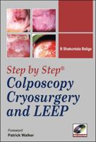 Step-By-Step Colposcopy, Cryosurgery, and Leep 0071634282 Book Cover