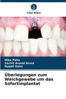 Überlegungen zum Weichgewebe um das Sofortimplantat 6205321726 Book Cover