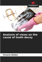 Analysis of views on the cause of tooth decay 6205681021 Book Cover
