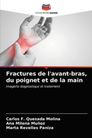 Fractures de l'avant-bras, du poignet et de la main 6203332674 Book Cover