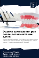 Оценка заживления ран после депигментации десны: оценка заживления ран после депигментации десны с помощью керамического бора для обрезки мягких тканей в сравнении с диодным лазером 6204070045 Book Cover