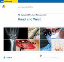 AO Manual of Fracture Management -  Hand and Wrist 158890265X Book Cover