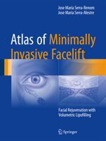 Atlas of Minimally Invasive Facelift: Facial Rejuvenation with Volumetric Lipofilling 3319330160 Book Cover