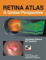 Retina Atlas: A Global Perspective 0071634401 Book Cover
