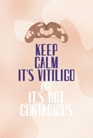 Keep Calm It's Vitiligo And It's Not contagious: Notebook Journal Composition Blank Lined Diary Notepad 120 Pages Paperback Nude Texture Vitiligo 1707043485 Book Cover