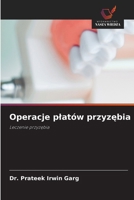 Operacje platów przyzebia (Polish Edition) 6209904696 Book Cover