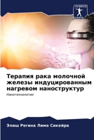 Терапия рака молочной же 6206873315 Book Cover
