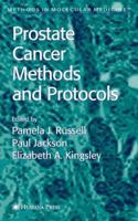 Prostate Cancer Methods and Protocols 1489938508 Book Cover
