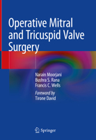 Operative Mitral and Tricuspid Valve Surgery 1447142039 Book Cover