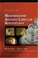 Atlas of Microkeratome Assisted Lamellar Keratoplasty 1556427425 Book Cover