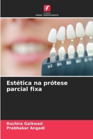 Estética na prótese parcial fixa (Portuguese Edition) 6209813682 Book Cover