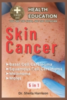 Skin Cancer: Basal Cell Carcinoma, Squamous Cell Carcinoma, Melanoma Skin Cancer, Mole: Types, Symptoms, Causes, Diagnosis, Treatment, Medications, ... SHELF: YOU SEE THE SIGNS, SEE THE PHYSICIAN) B0CNP2BLC2 Book Cover