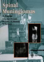 Spinal Meningiomas 8847022622 Book Cover